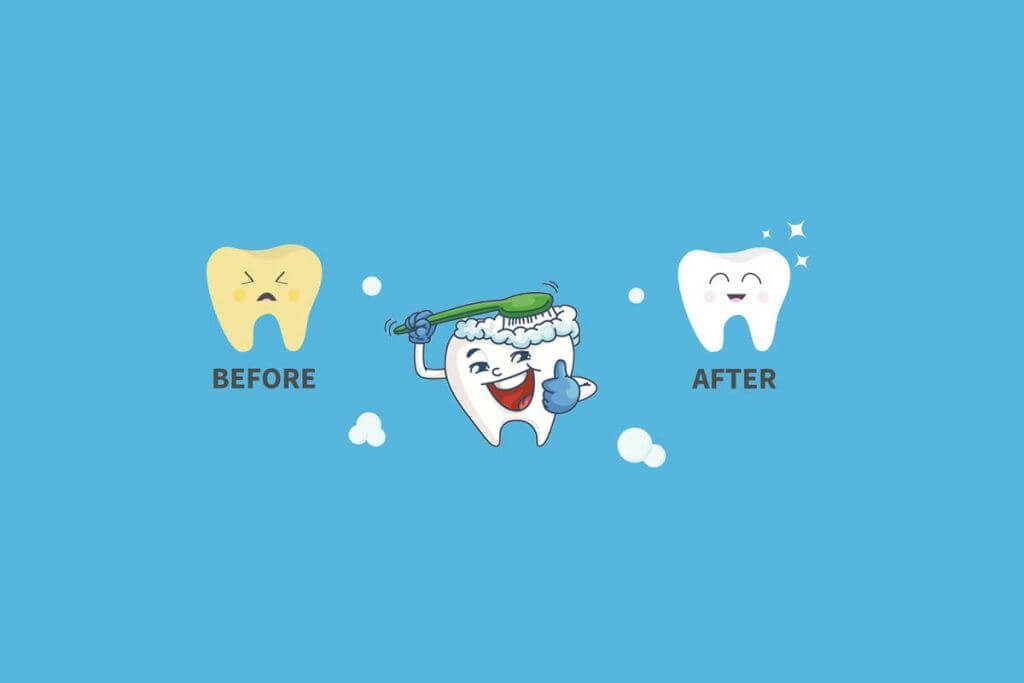 Teeth Whitening And Kids