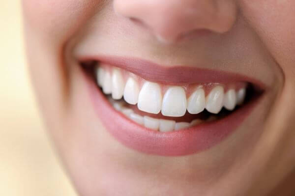 Teeth Whitening – You Deserve A Beautiful Smile