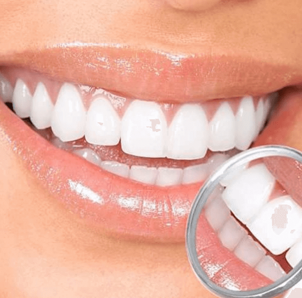 5 Misconceptions About Orthodontic Treatment