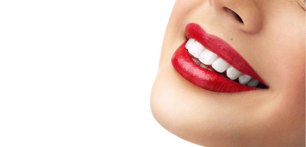 Is Teeth Whitening Right For You? : 5 Things You Should Know