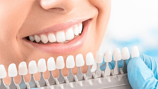 How to Choose the Right Shade for Teeth Whitening