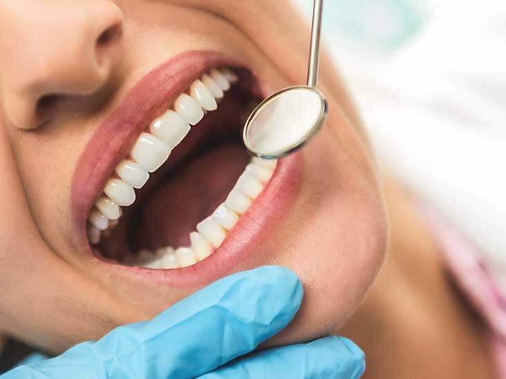 What You Need To Know About Dental Erosion