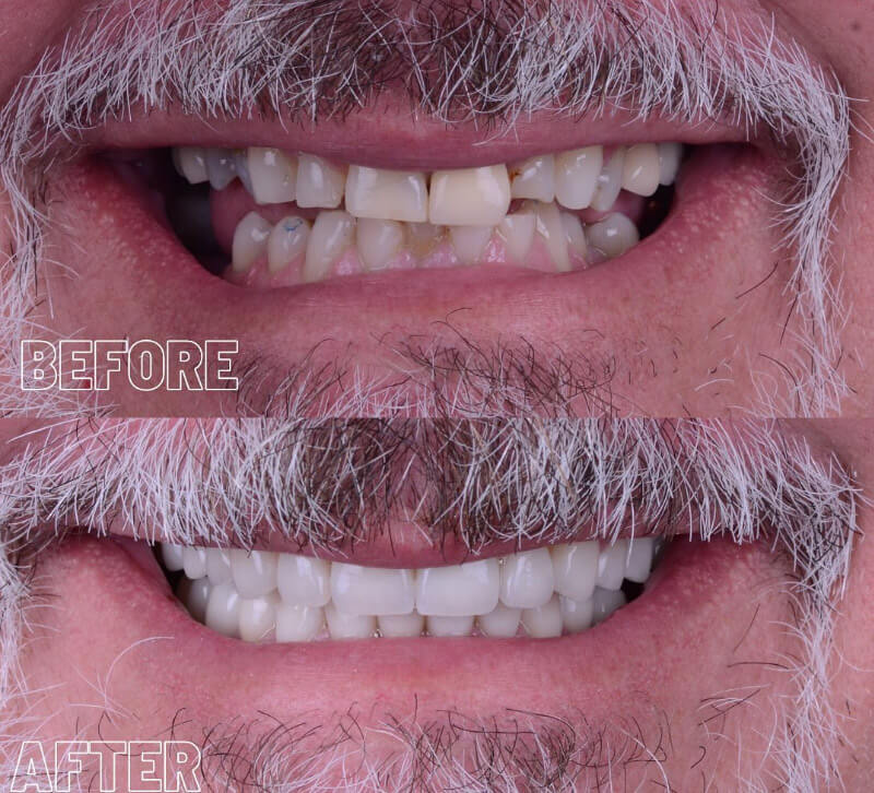 What Cosmetic Dentistry Can Do For You And Your Smile