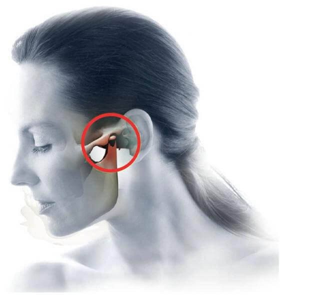 Everything You Need To Know About TMJ Disorders And How To Manage Them